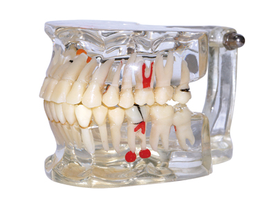 HST-C2缺失伸長(zhǎng)模型