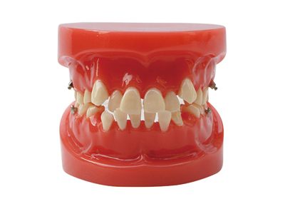 HST-B1 ORTHODONTIC MODEL HST-B1 ORTHODONTIC MODEL