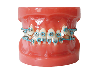 HST-B1-01 Ortho Metal Bracket Model HST-B1-01 Ortho Metal Bracket Model