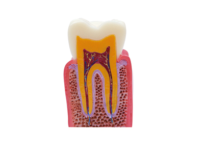 HST-M2 6倍齲齒雙側(cè)對比