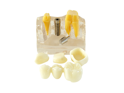 HST-M3-02種植醫患溝通