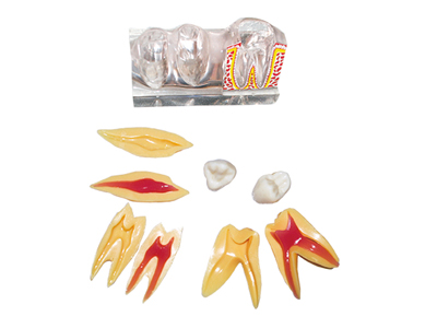 HST-M4-02四倍牙體分解模型