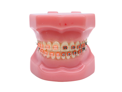 HST-B3-02半金屬半陶瓷