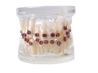 HST-B5-01全金屬托槽