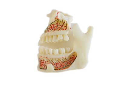 P4上下頜骨教學模型