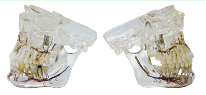 透明病理模型（帶神經線）