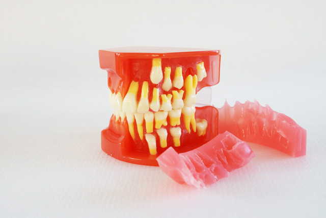 HST-E2 5-9歲牙列發育模型 