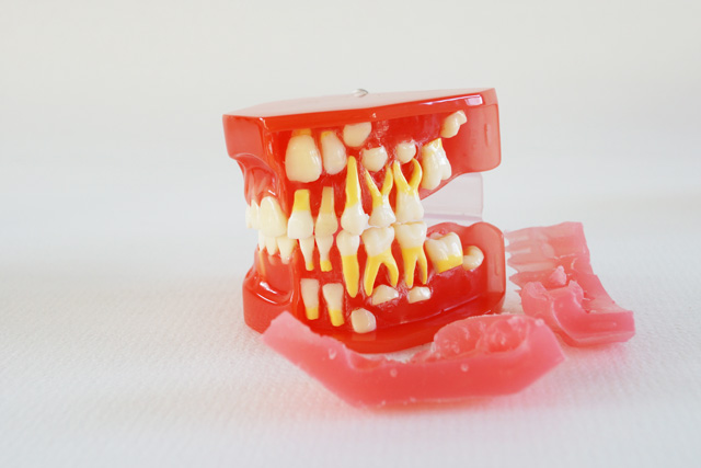 HST-E3 9-12歲牙列發育模型